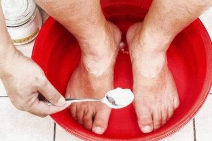 Leczenie grzyba na kciuku nogi